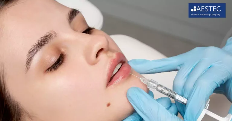 เอสเตฟิล ราคา 2026 อัปเดตล่าสุด