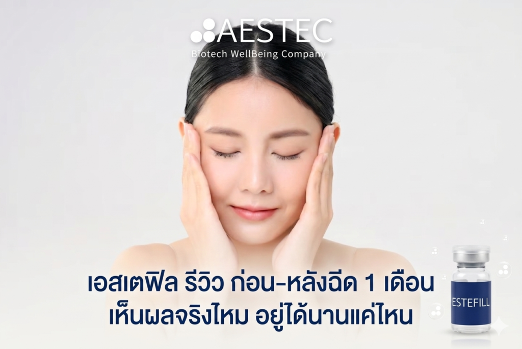 เอสเตฟิล รีวิว ก่อน หลังฉีด 1 เดือน
