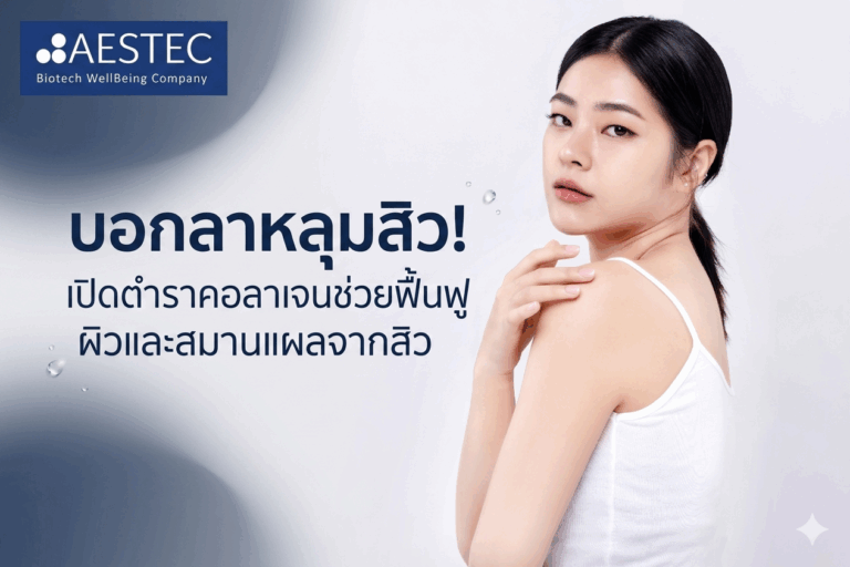 บอกลาหลุมสิว! เปิดตำราคอลลาเจนช่วยฟื้นฟูผิวและสมานแผลจากสิว