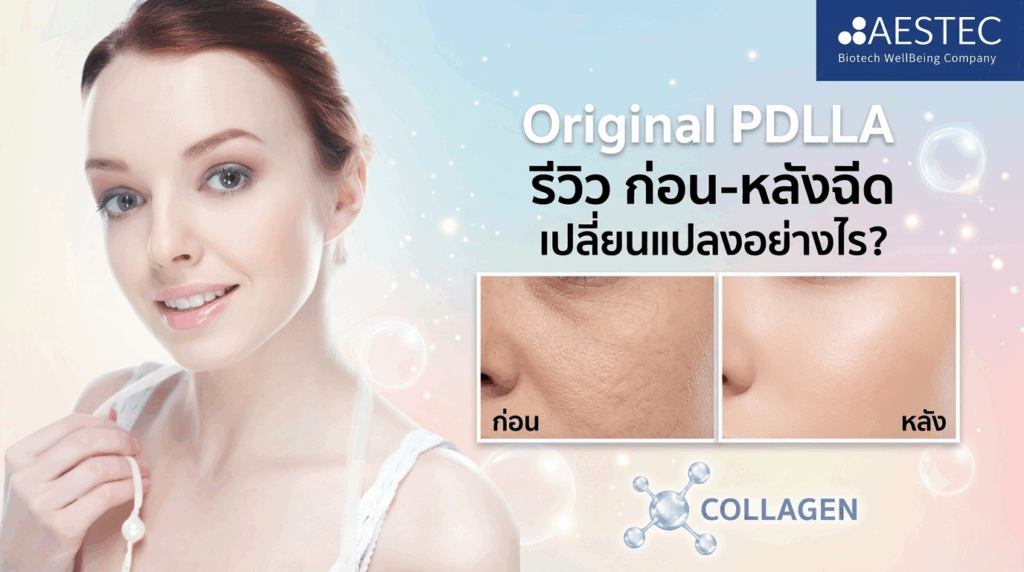 Original PDLLA รีวิว ก่อน-หลังฉีด เปลี่ยนแปลงอย่างไร